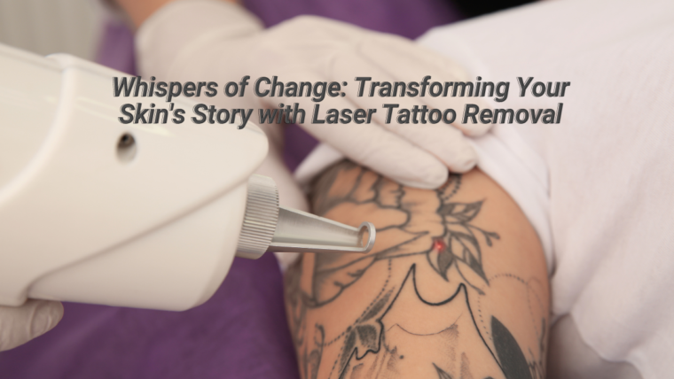 Fading the Ink: A Journey into Laser Tattoo Removal