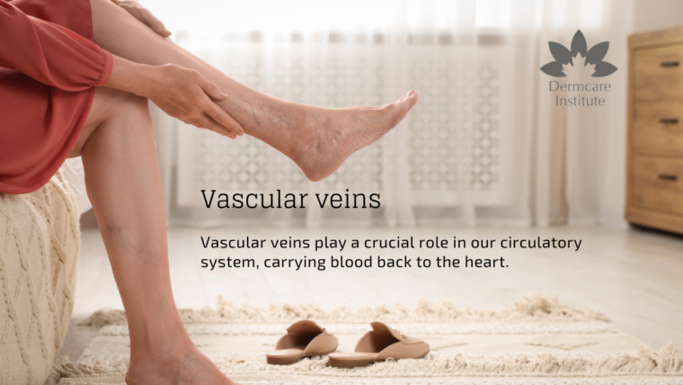 Vascular Veins Unraveled: Know the Differences, Recognize the Signs